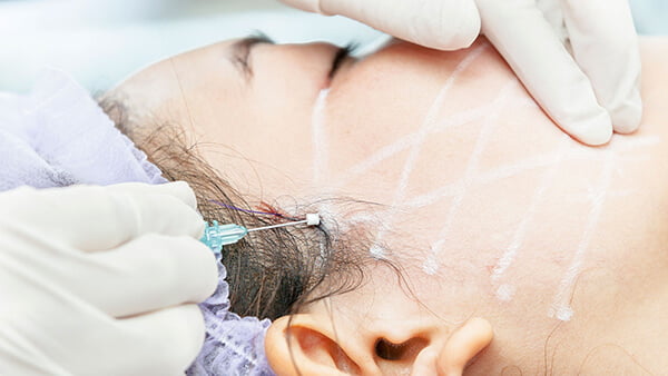 silhouette soft niti SILHOUETTE SOFT NITI