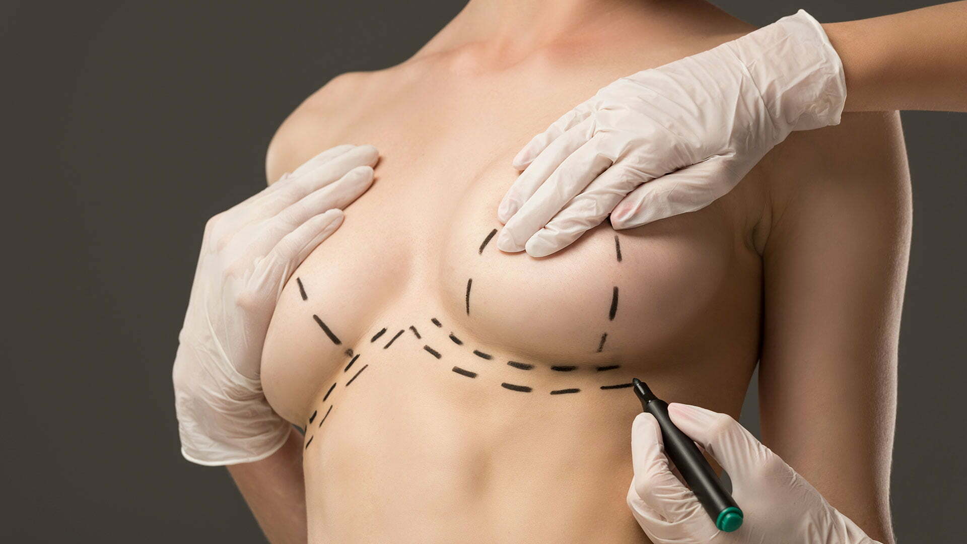 plastična hirurgija grudi eterna