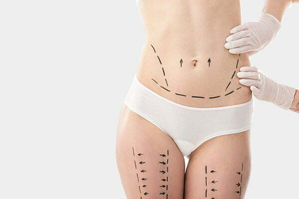 plastična hirurgija telo